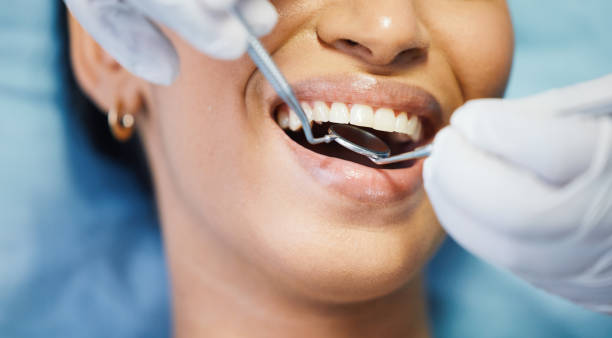 Best Emergency Dental Care for Broken or Chipped Teeth in Highlands, NJ